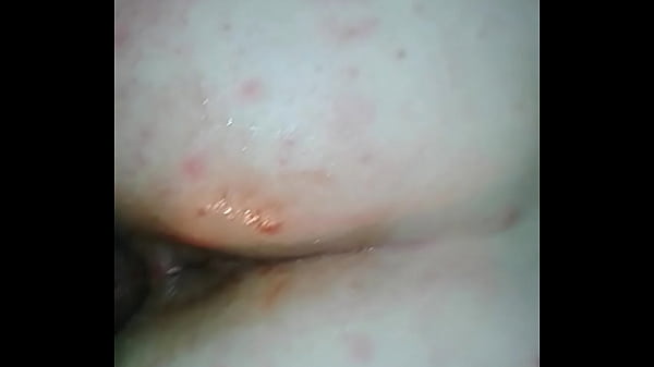 20151022 080335