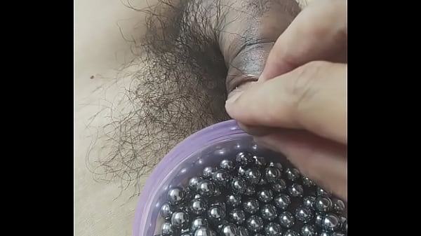 膀胱の中の玉です