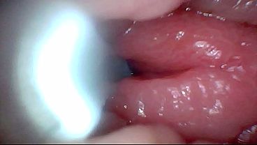 Debut: An Endoscope Reveals The G-spot Up Close – Without Saddling!