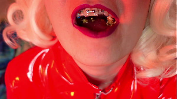 Food Obsession - ASMR Mukbang Video In BRACES