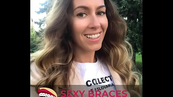 Cute Hotties With Braces Flaunting Their Smile!