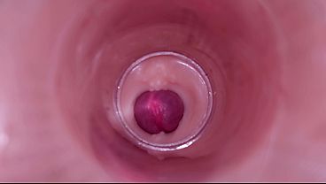 Female Insemination - Internal Camera Captures Thorough Male Ejaculation