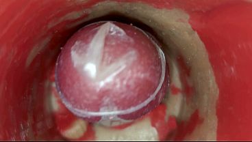 The Camera Inside The Intense Cooch Records A Giant Ejaculation With A Stuck Condom