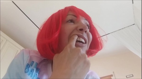 Chantal's Teeth Fall Apart, Rotten And Black
