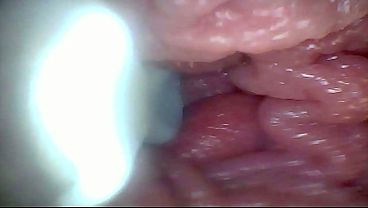 Endoscope Camera Reveals The Most Sensitive Parts Of The Penis Educational Video