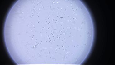 Look At My Unspoiled Sperm Swimming Under Microscope - For Honeys Who Lust It