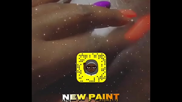Hand Kink
