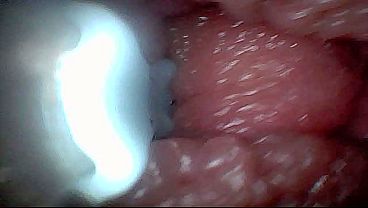 Visual Guide To G-Spot Stimulation And Climax — Endoscop Perspective