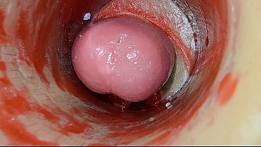 Camera Inside Deep Snatch Captures Dose Ejaculation Of Sperm ASMR