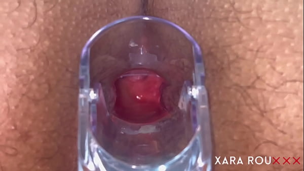 Ass Play Vision Speculum