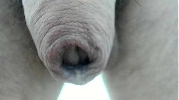 My Foreskin Superclose :)