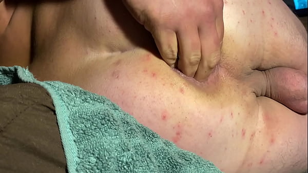 Fingering My Rear Until My Prostate Orgasms And Splitting My Orifice