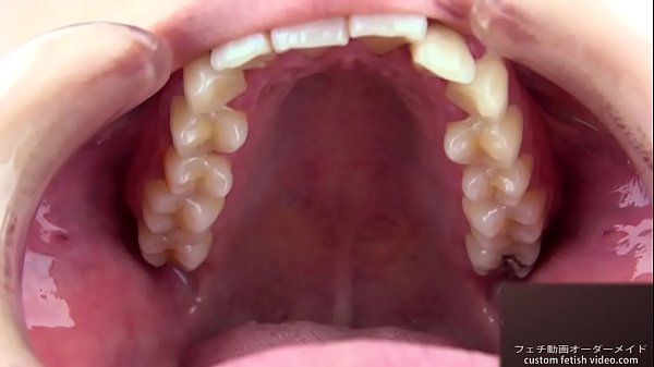 Teeth Kink