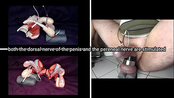 Electrical Stimulation Of The Testicles