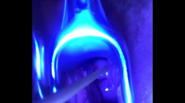 Swollen Full Cervix Absolutely To Be Crammed With Spunk Is Spreaded Out And Sounded