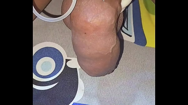 Myanmar Gay Cocklovermlm Private Saline Injection