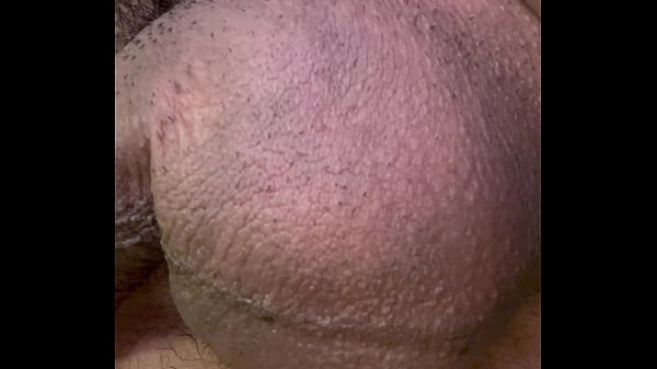 HUEVOS PELLIZCADOS CON PINZAS