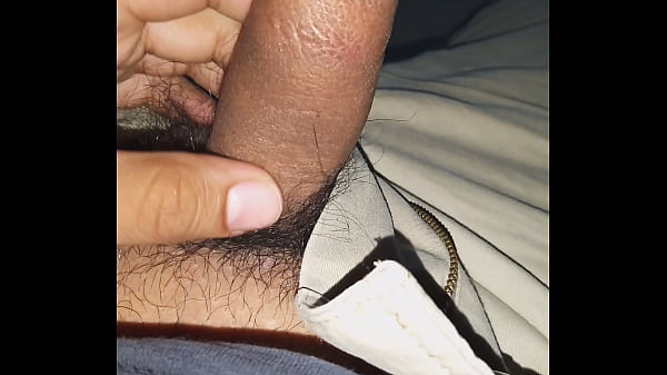Prepucio
