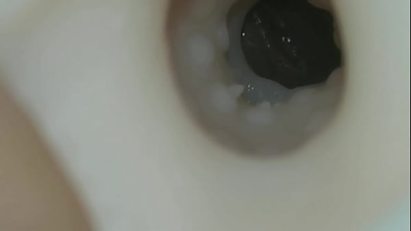 Hướng Dẫn Cách Lấy Tinh Trùng