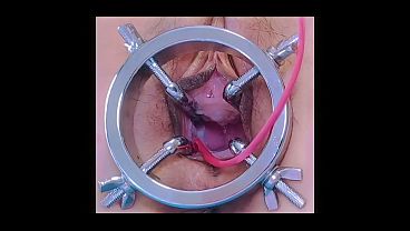 Urethraplay Is So Fan-like!Catheter Jerking Off And Urethral Sounding Are My Favorites!