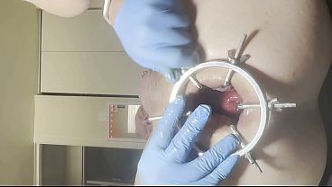 Reneenicolecd - Update #85 - Anal Spreader -Spikey Sack - Apple - Vaccuum - Aug 10, 2026