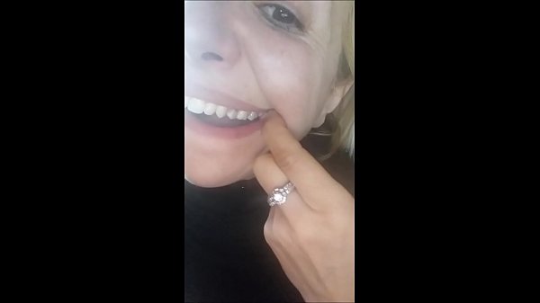 Ravishing Face, But Rotten Teeth!