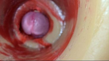 Female Insemination - Internal Camera Captures Intense Male Massive Ejaculation