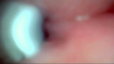 Endoscope Camera Captures Moment Of Male Ejaculation