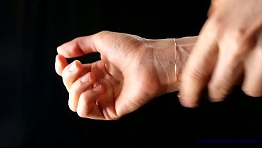 Hand Veins Fixation