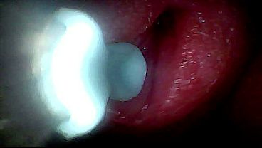 I Couldn’t Believe What Happens INSIDE The Penis As Sperm Passes Through (endoscopic Footage)